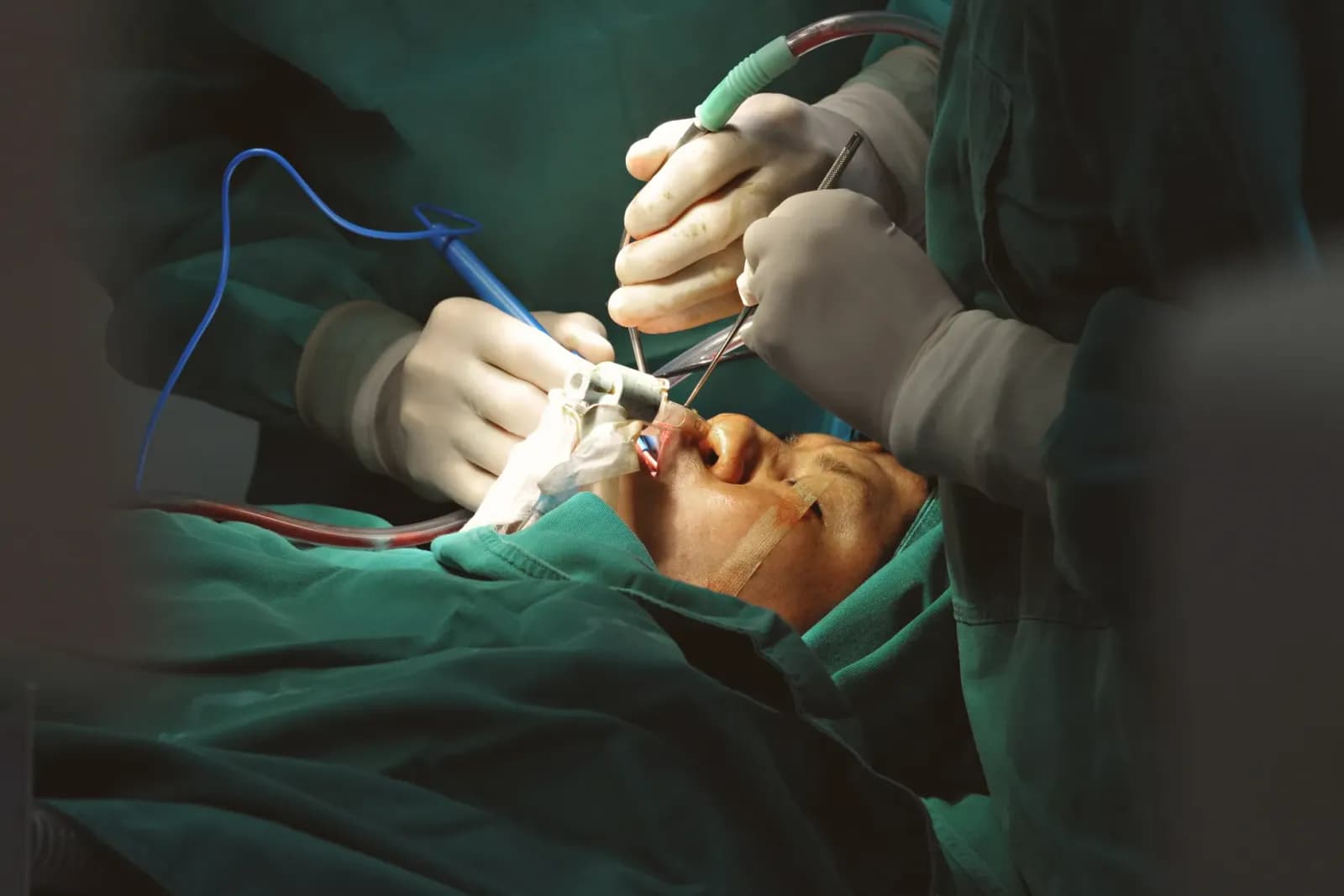 ameliyathanede çalışan plastik cerrah, hasta ile görüşen doktor, cerrahi ekipmanlar